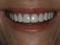 Konig Center for Cosmetic & Comprehensive Dentistry smile photos